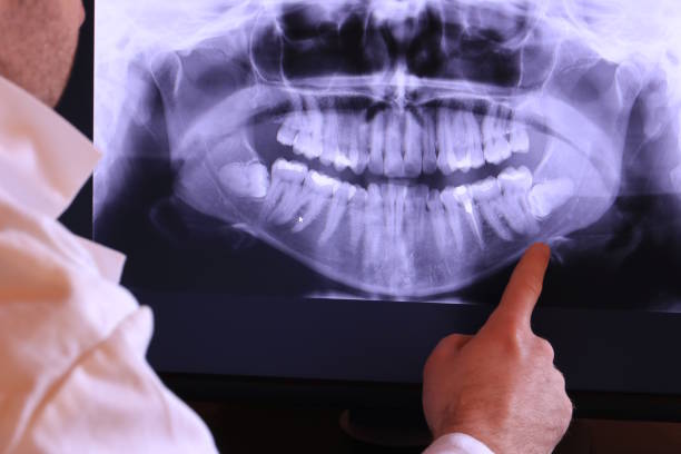 Best Emergency Treatment for Toothache in Collinsville, VA