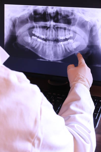 Best Emergency Tooth Extraction in Collinsville, VA