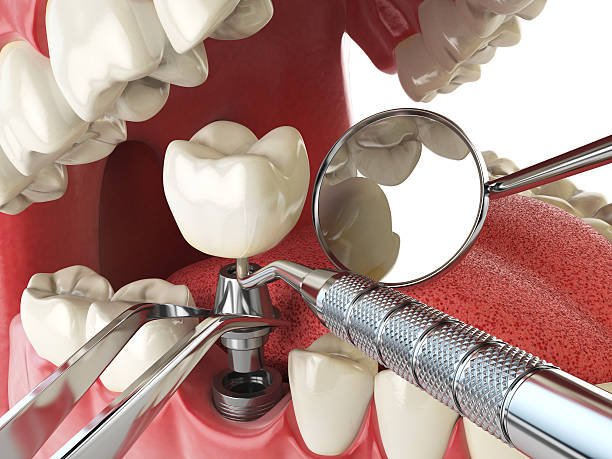 Best After-Hours Emergency Dentist in Collinsville, VA